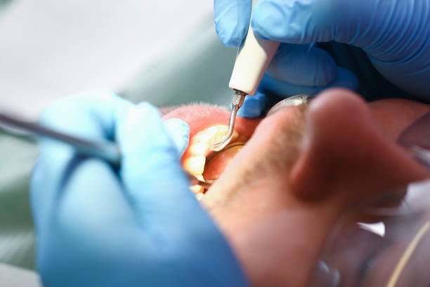 Best Emergency Treatment for Toothache in Cairo, GA