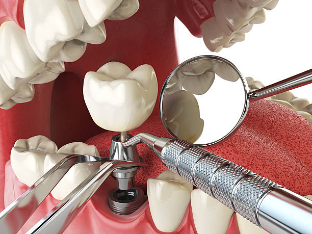 Best After-Hours Emergency Dentist in Cairo, GA