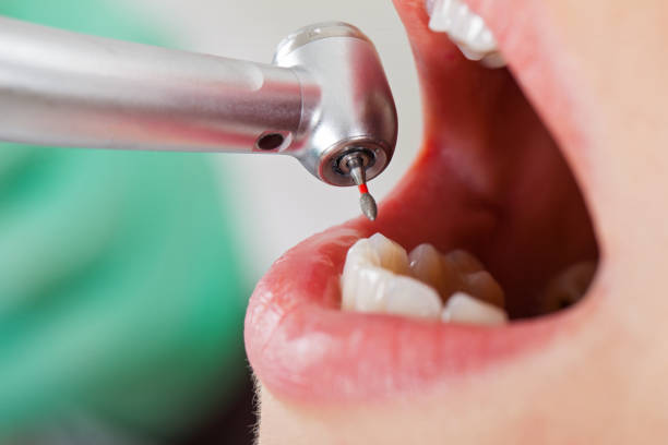 Best Emergency Dental Care for Trauma or Injury in Cairo, GA